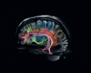 Imagen cerebro